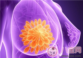 产后乳腺增生会成为乳腺癌吗  乳腺增生如何自行检查