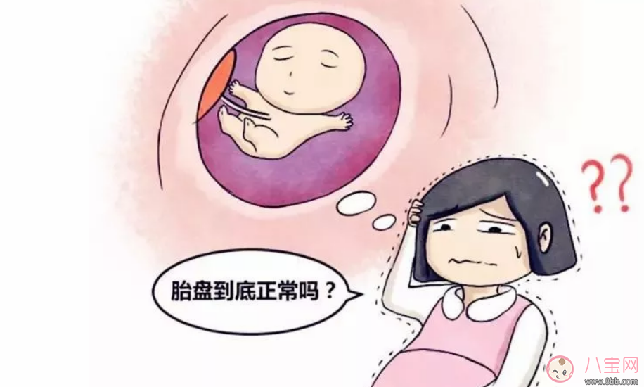 孕妇前置胎盘正常吗 前置胎盘要做哪些检查