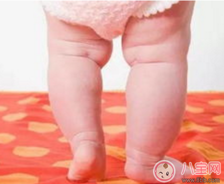 宝宝罗圈腿怎么矫正 怎么判断是不是罗圈腿