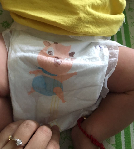 小鹿叮叮纸尿裤适合夏天吗 小鹿叮叮纸尿裤会红屁股吗 小鹿叮叮纸尿裤适合夏天吗 小鹿叮叮纸尿裤会红屁股吗