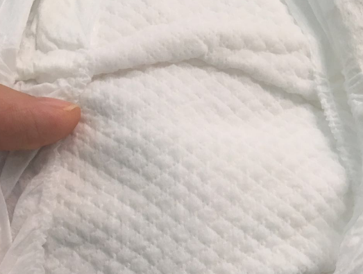 小鹿叮叮纸尿裤适合夏天吗 小鹿叮叮纸尿裤会红屁股吗 小鹿叮叮纸尿裤适合夏天吗 小鹿叮叮纸尿裤会红屁股吗