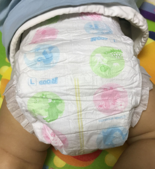 大王维E纸尿裤会反渗吗 大王维E纸尿裤好不好用