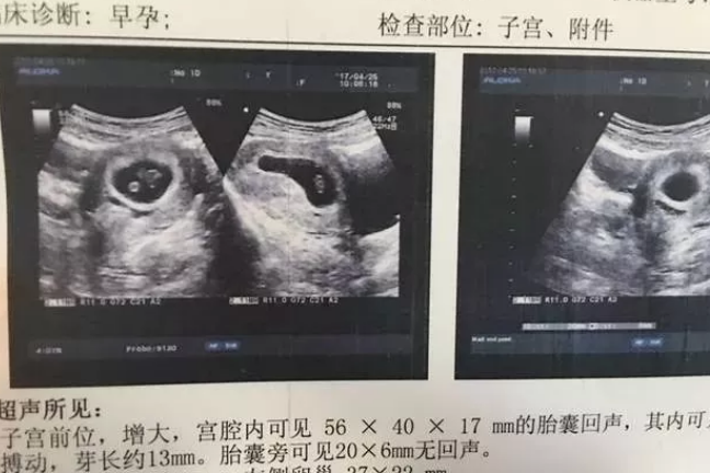 2018年10月12号行房受孕生男生女 农历九月初四怀孕生男孩还是女孩