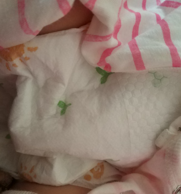 爱得利纸尿裤会红屁股吗 爱得利纸尿裤好不好用