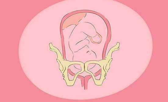 胎儿迟迟不入盆怎么办  胎儿入盆动作推荐