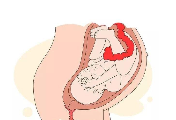 入盆后孕妇体重会下降吗 胎儿入盆是不是生得快