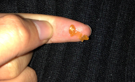 小鹿邦邦DHA藻油味道怎么样 小鹿邦邦DHA藻油孕妇吃好吗 小鹿邦邦DHA藻油味道怎么样 小鹿邦邦DHA藻油孕妇吃好吗