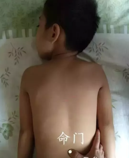 孩子肾气不足怎么办 推拿补肾的方法