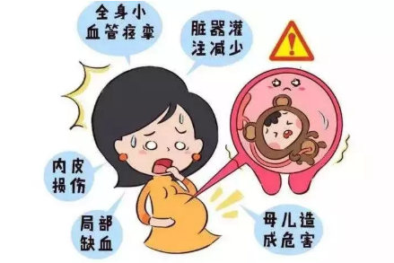 妊娠期高血压能顺产吗 妊娠期高血压只能剖腹产吗