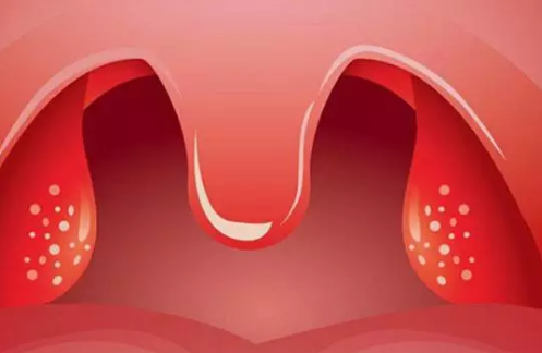 宝宝为什么会患得扁桃体炎 宝宝扁桃体发炎怎么应对