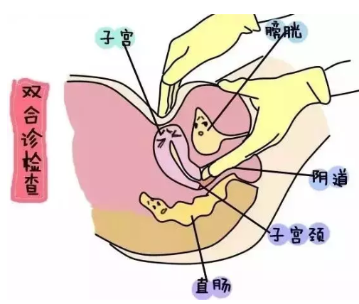 子宫后位迅速怀孕的技巧 哪些疾病会造成子宫后位