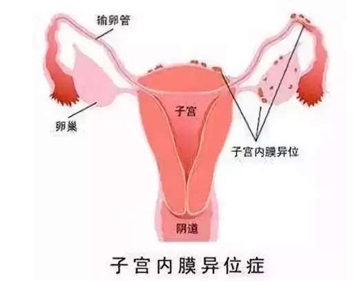 有卵泡不排卵吃什么药 有卵泡不排卵怎么排卵怀孕