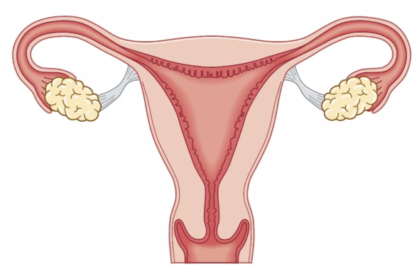 子宫内膜异位症和遗传有关吗 子宫内膜异位症能做试管婴儿吗