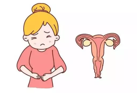 子宫内膜炎怎么检查出来 慢性子宫内膜炎要做哪些检查