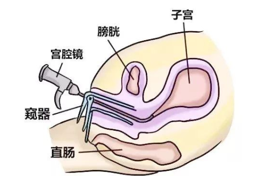 非经期出血是什么原因 非经期出血褐色正常吗