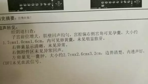 宫角妊娠的症状有哪些 宫角妊娠的后果都有哪些