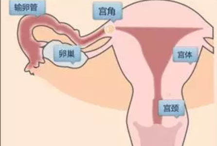 宫角妊娠的原因有哪些 宫角妊娠是如何引起的