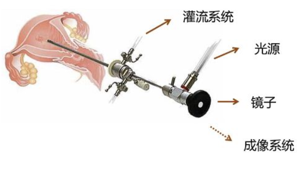 宫腔镜检查价格贵不贵 宫腔镜检查多少费用