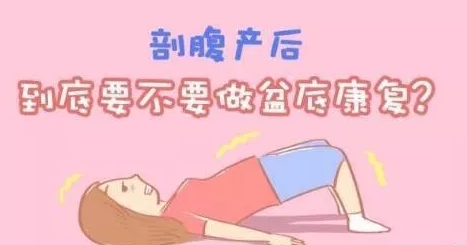 盆底肌治疗等到二胎做好吗 盆底肌治疗等生完二胎可以吗