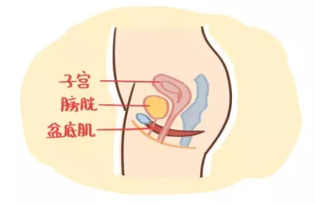 盆底肌治疗等到二胎做好吗 盆底肌治疗等生完二胎可以吗