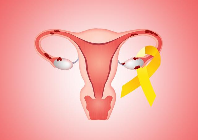 子宫内膜炎有什么危害 女性子宫内膜炎如何治疗