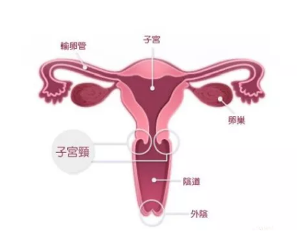 宫颈糜烂是怎么引起的 宫颈糜烂到底要不要治疗