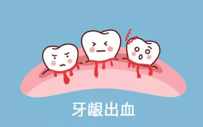 牙齿一刷就流血怎么办 为什么会出现牙龈出血的情况
