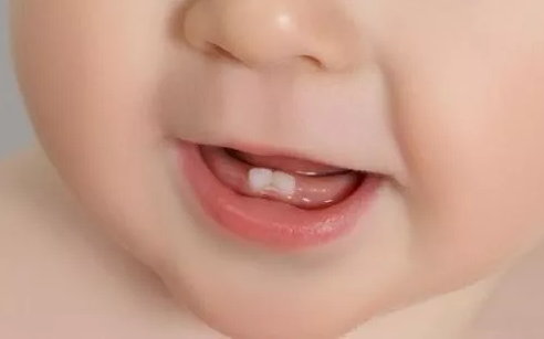 宝宝开始长牙的表现有哪些 宝宝长牙要注意什么