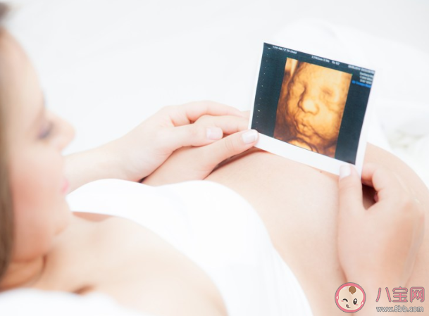 孕早期是致畸敏感期吗 孕期有哪些致畸因素