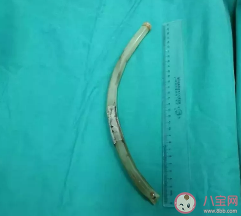 暴食催吐管在电商平台公开售卖是怎么回事 暴食催吐的危害是什么