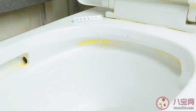 马桶发黄洗不掉怎么办 马桶发黄有异味是什么原因 马桶发黄洗不掉怎么办 马桶发黄有异味是什么原因