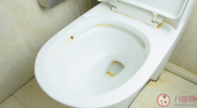 马桶发黄洗不掉怎么办 马桶发黄有异味是什么原因 马桶发黄洗不掉怎么办 马桶发黄有异味是什么原因