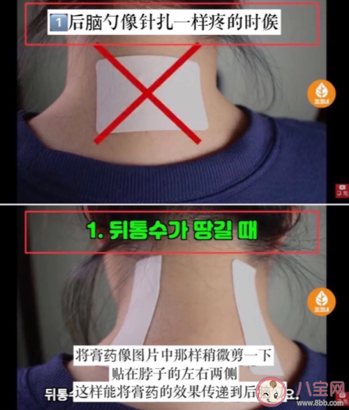 膏药的正确贴法是什么 膏药使用注意事项