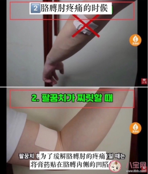 膏药的正确贴法是什么 膏药使用注意事项
