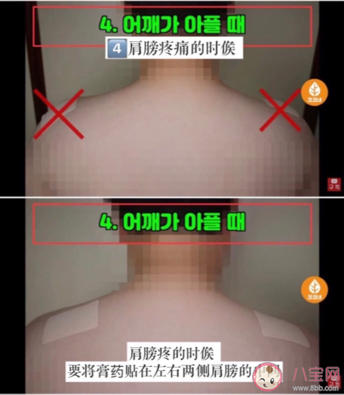 膏药的正确贴法是什么 膏药使用注意事项