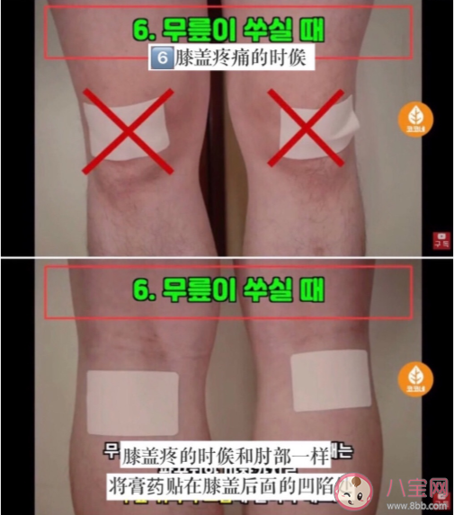 膏药的正确贴法是什么 膏药使用注意事项