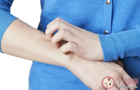 湿疹是不是湿热引起的吗 干性湿疹的症状是什么