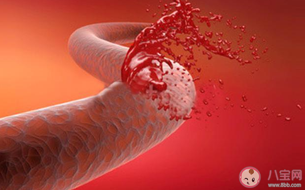 孩子大便带血会有哪些病 宝宝便血怎么办