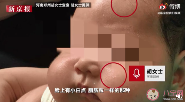 江西哪款婴儿抑菌霜被曝激素严重超标 怎么避免买到伪劣儿童面霜