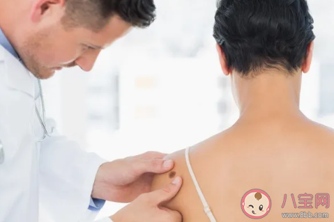 点完痣后当天可以敷面膜吗 点痣后什么时候可以擦护肤品