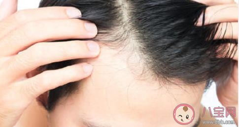 男青年最热衷的医美项目是植发吗 植发后有哪些注意事项