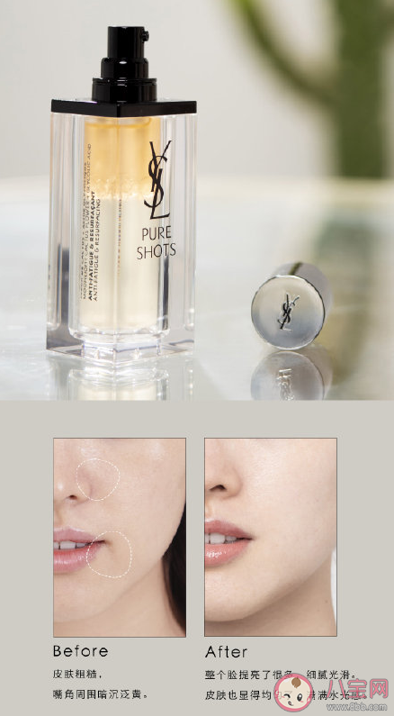 YSL夜皇后精华适合油痘肌吗 YSL夜皇后精华好用吗
