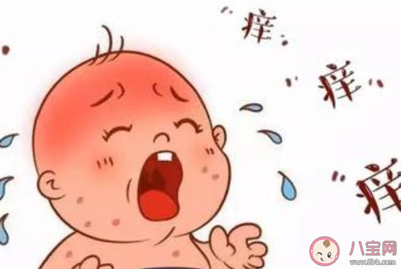 怎样鉴别新生儿面疱和湿疹 面疱和湿疹具体区别是什么