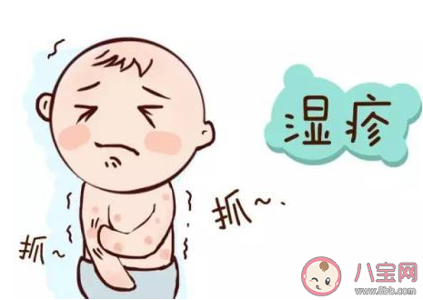 怎样鉴别新生儿面疱和湿疹 面疱和湿疹具体区别是什么