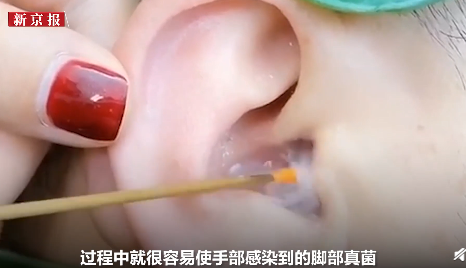 男子采耳后耳朵感染脚气怎么回事 耳朵为什么会患脚气病