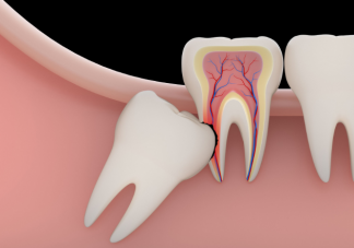 智齿每个人都会长吗 智齿不痛要拔吗