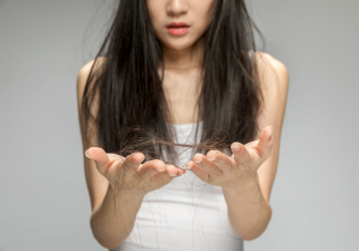 关于脱发的10条真相科普 当代年轻人为什么严重脱发