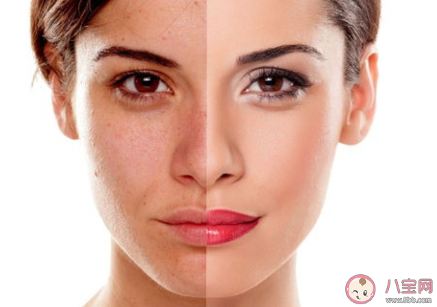 多云天气紫外线更强吗 紫外线对皮肤的伤害有哪些