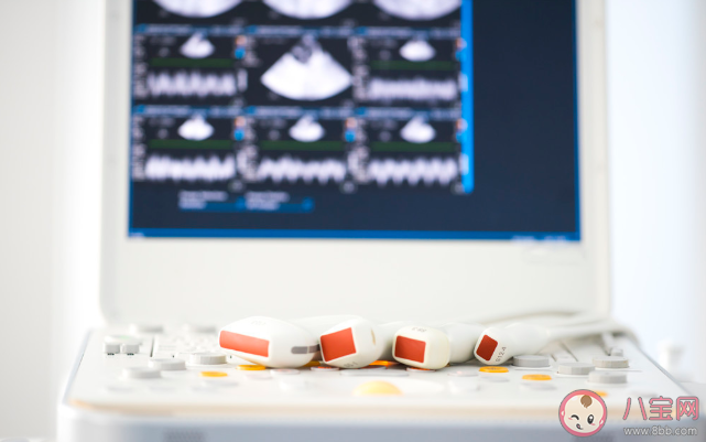 彩色B超是彩色的吗 彩超为什么不是彩色的 彩色B超是彩色的吗 彩超为什么不是彩色的