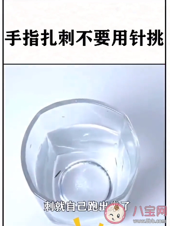 手指扎刺针挑不出来怎么办 轻松取出手指扎刺的方法有哪些